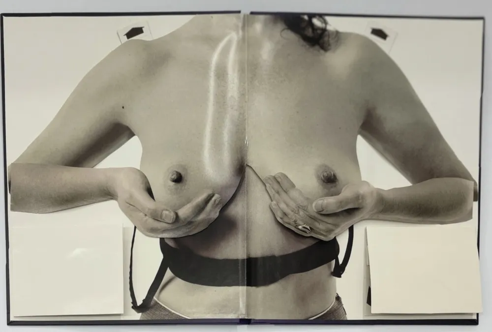 写真 Calle - Les seins miraculeux (Beautiful breasts)