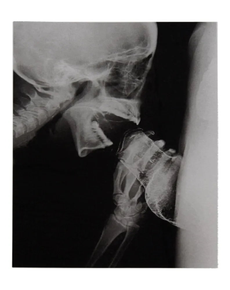 挿絵入り本 Delvoye - Sexrays