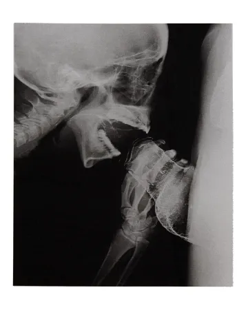 挿絵入り本 Delvoye - Sexrays