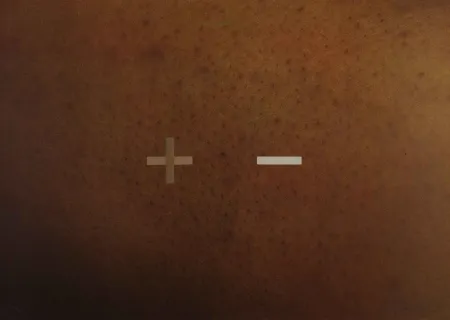 シルクスクリーン Dias - S.T.