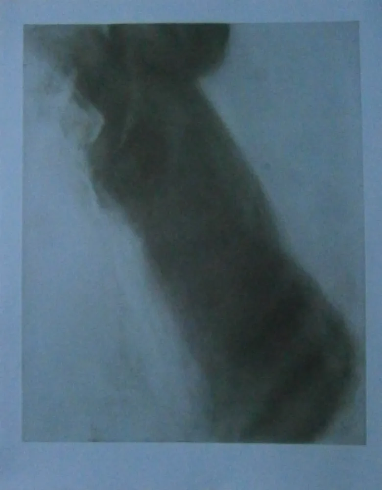 エッチング Garache - Bleue