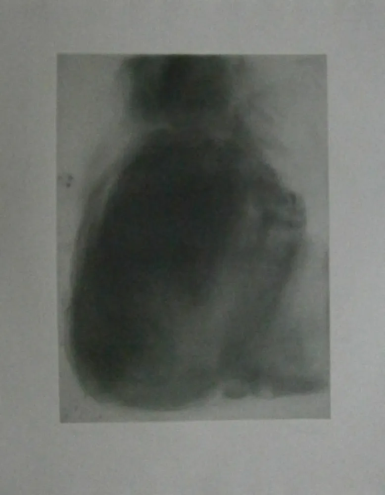 エッチング Garache - Tourette