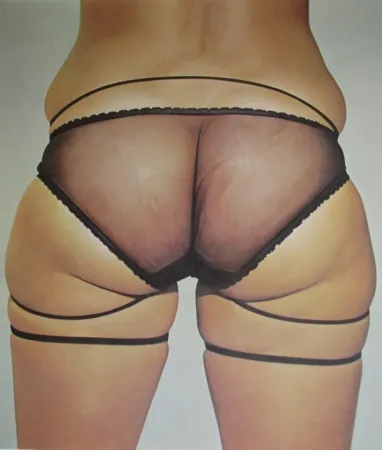 リトグラフ Kacere - Loretta 