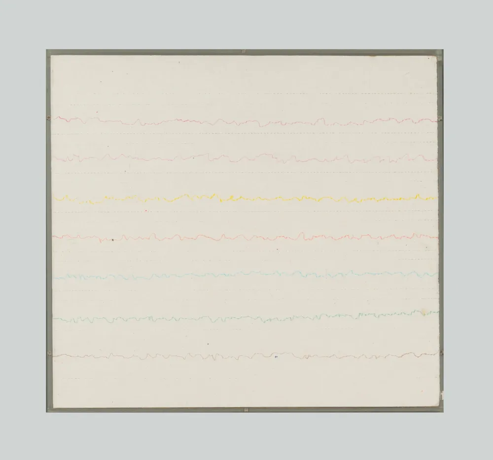 技術的なありません Masi - Senza titolo