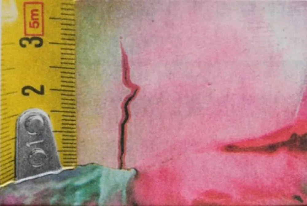 写真 Mcbride - Untitled (Rulers II)