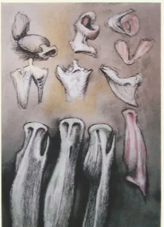 リトグラフ Moore - Tree sisters