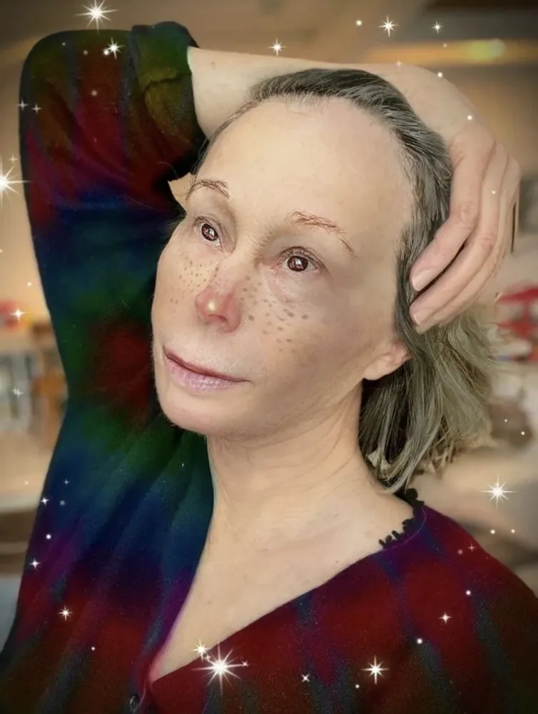 多数の Sherman - Untitled (Twinkle-Nose)